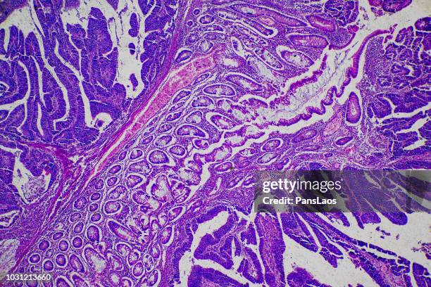 Cancer Research